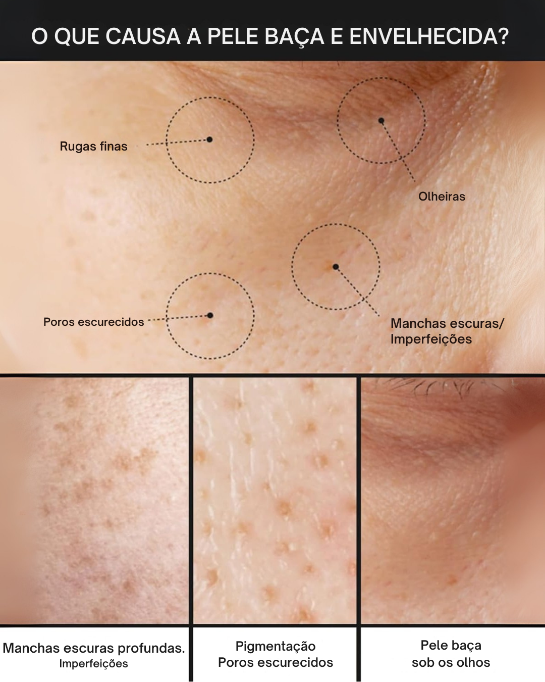 Creme Anti-manchas Pore+: Hidratante, Não Irritante e Redutor de Poros (EM PROMOÇÃO 2X1)