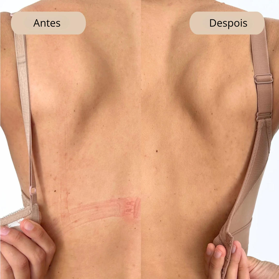 Soutien com Aros com Suporte e Conforto para Uso Diário. (OFERTA 2X1)