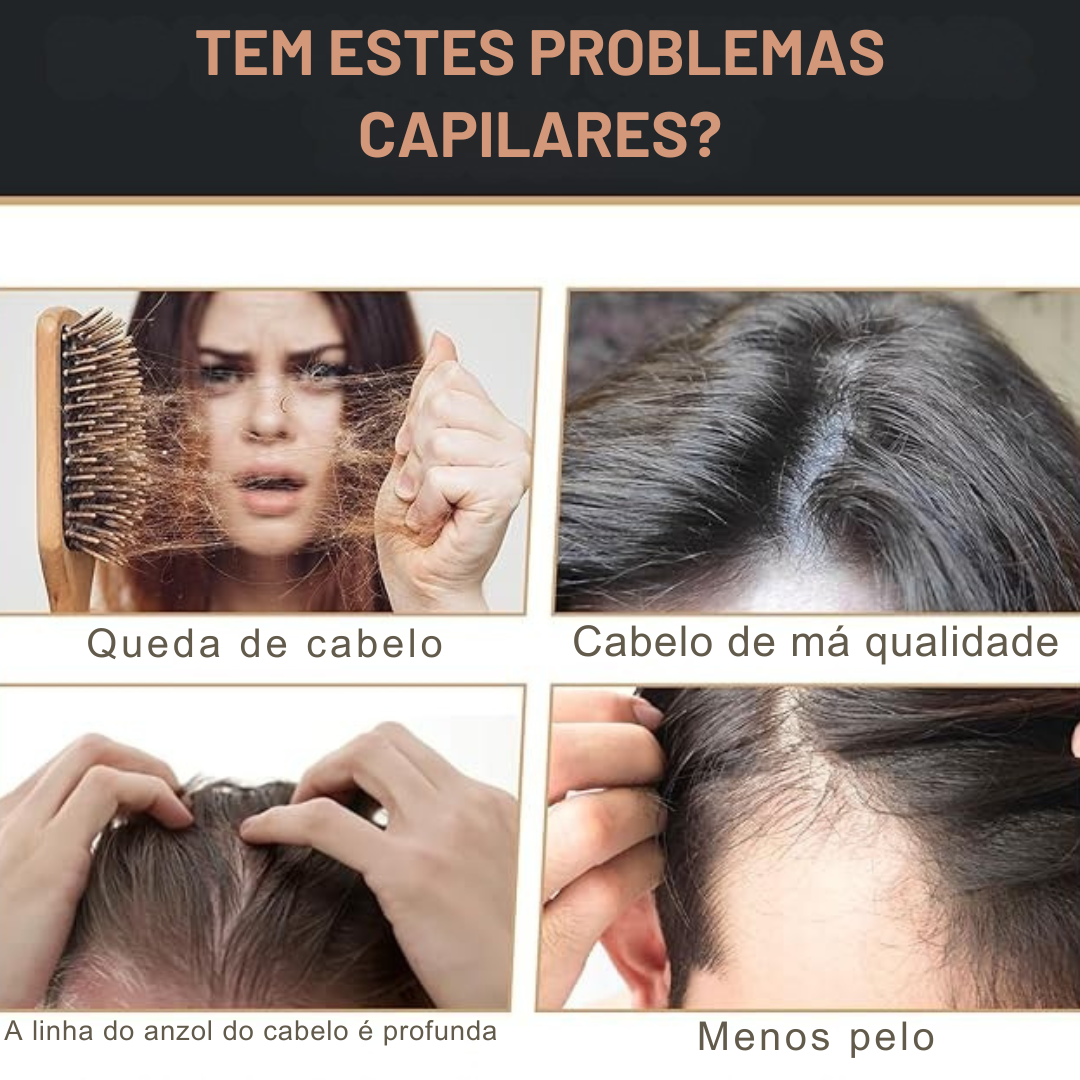 Tratamento capilar fortalecedor Batana Oil – 120 ml (OFERTA 2X1)