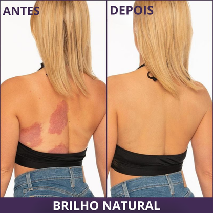 Maquilhagem Corporal de Alta Cobertura para Pernas e Corpo (OFERTA 2X1)