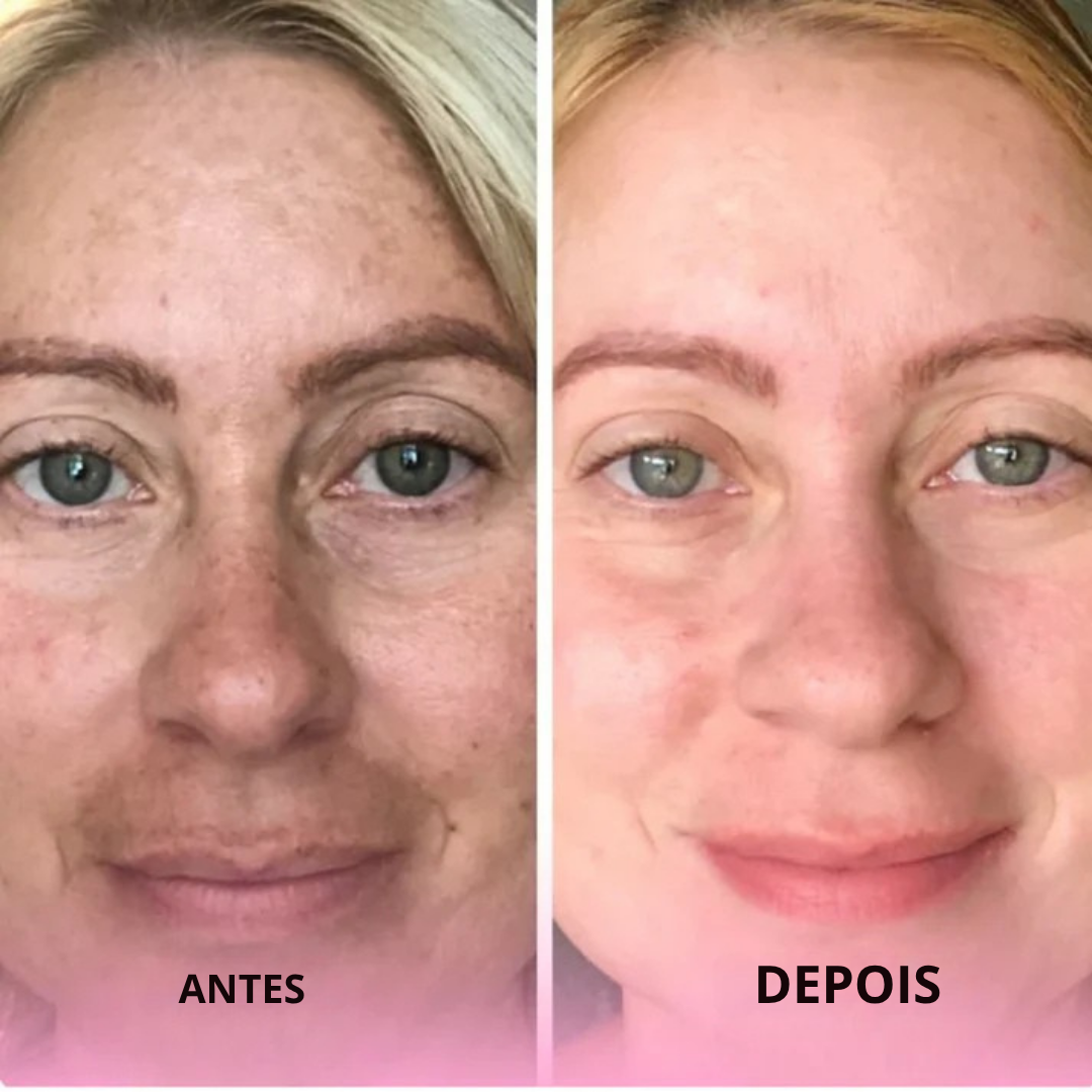 Algodões com curcuma e ácido kójico para reduzir manchas, 40 unidades (EM PROMOÇÃO 2X1)