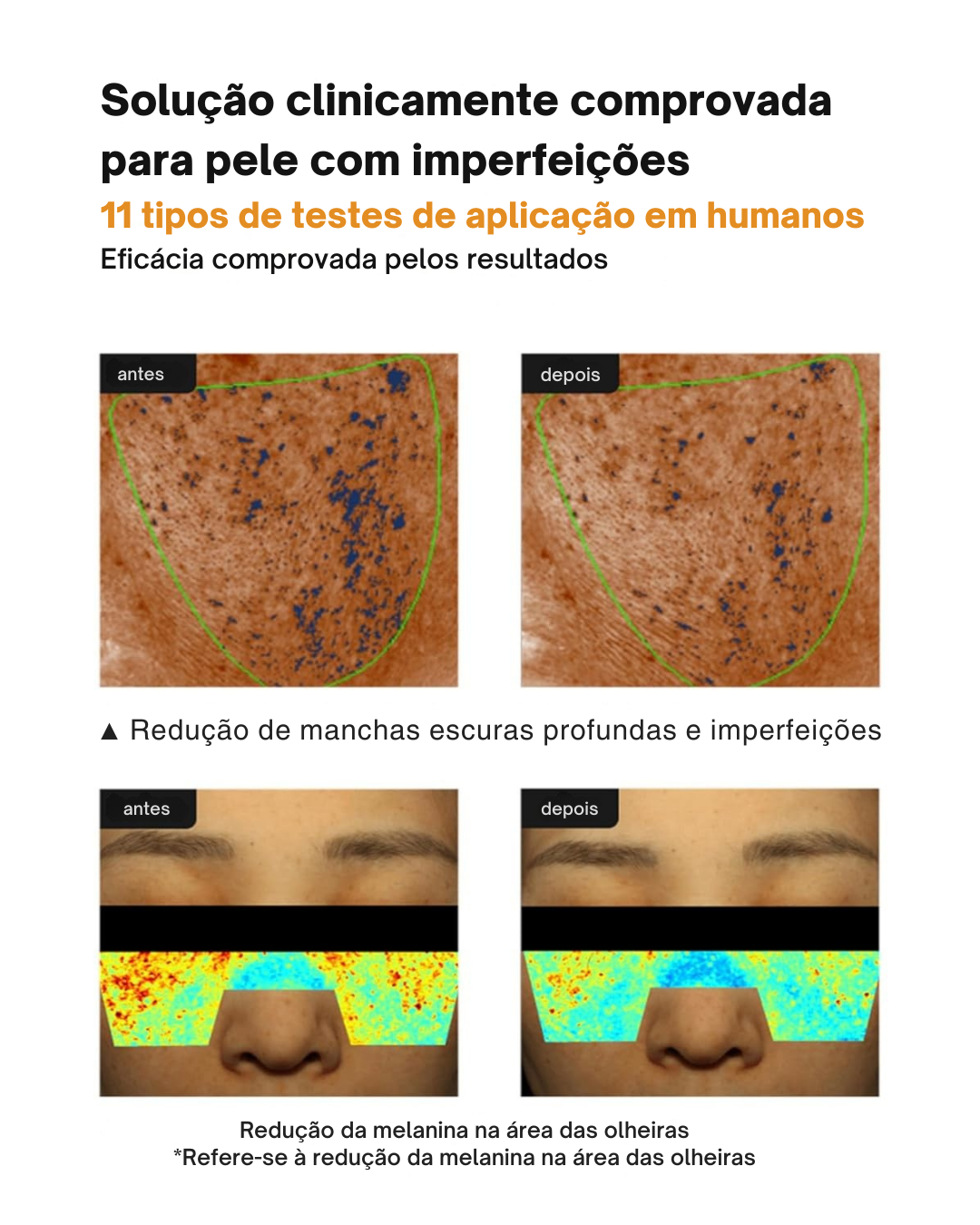 Creme Anti-manchas Pore+: Hidratante, Não Irritante e Redutor de Poros (EM PROMOÇÃO 2X1)