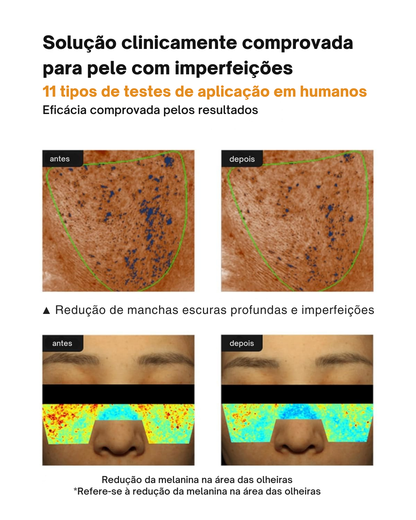 Creme Anti-manchas Pore+: Hidratante, Não Irritante e Redutor de Poros (EM PROMOÇÃO 2X1)