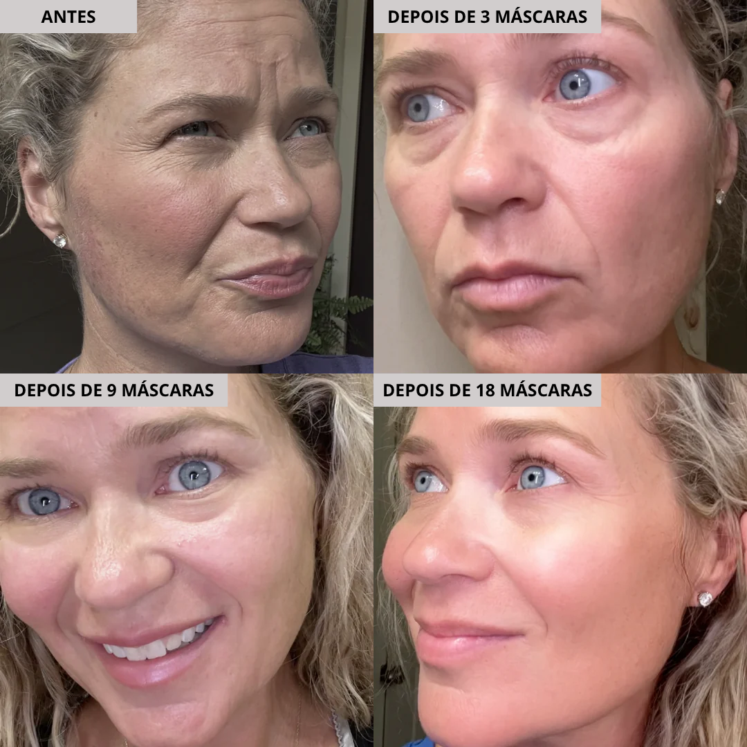 Máscara Hidratante de Colagénio 9 Unidades