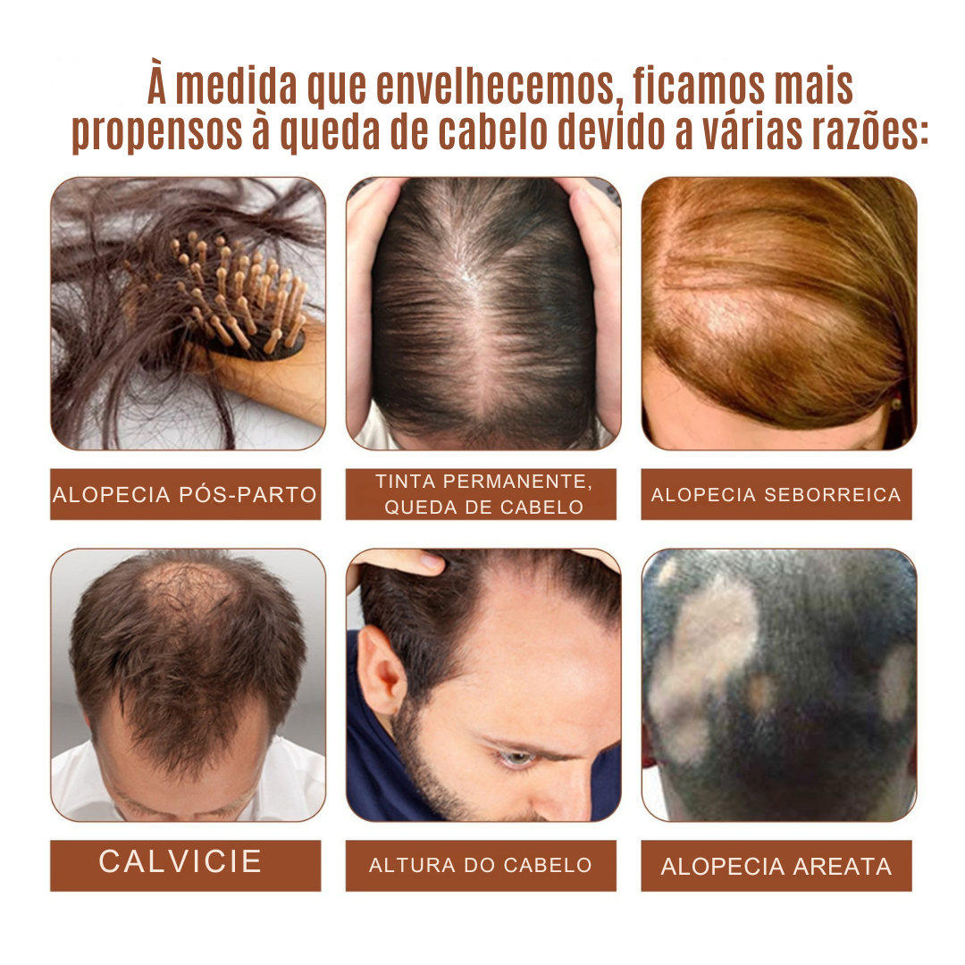 Tratamento capilar fortalecedor Batana Oil – 120 ml (OFERTA 2X1)